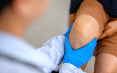 Opération du ménisque : quelle durée d’arrêt ?